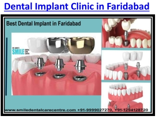 Best Dental Clinic in Faridabad For Implant and Invisible Aligner and Face Surge