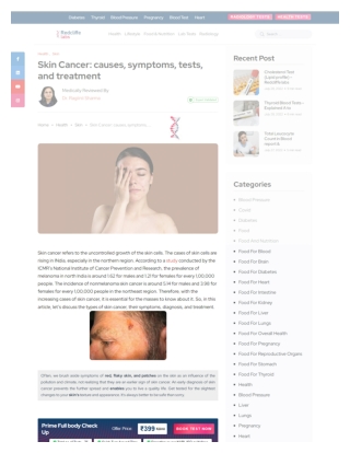 Skin Cancer: Causes, Symptoms, Tests, and Treatment - MyHealth