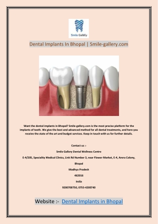 Dental Implants In Bhopal | Smile-gallery.com