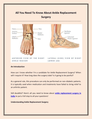 All You Need To Know About Ankle Replacement Surgery