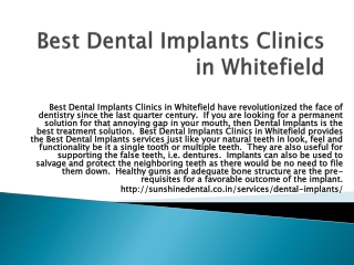 Best Dental Implants Clinics in Whitefield