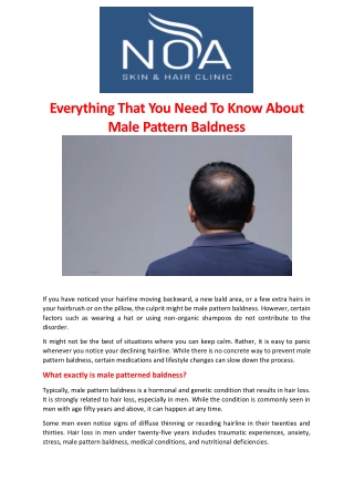 Everything That You Need To Know About Male Pattern Baldness