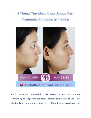 All That You Must Know About Post Traumatic Rhinoplasty in India