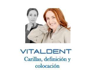 Vitaldent informa sobre las carillas dentales