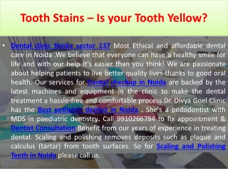 Dental checkup in noida