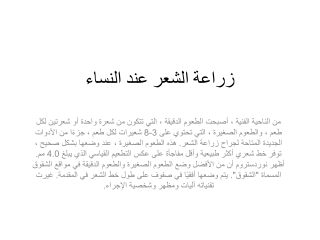 زراعة الشعر عند النساء