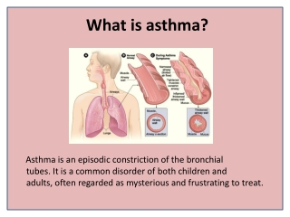 Get Asthma Relief Naturally without Drugs or Inhalers