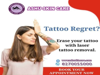 ashu skin care is best for laser tattoo remove clinic in bhubaneswar, odisha