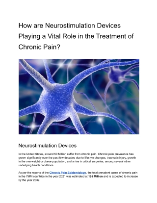 How are Neurostimulation Devices Playing a Vital Role in the Treatment of Chronic Pain