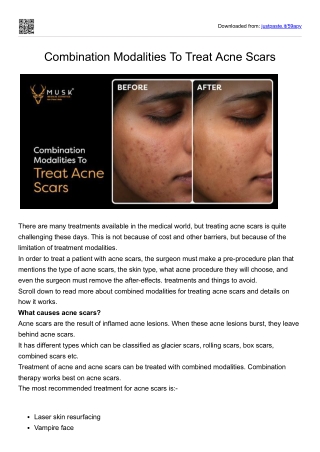 Combination Modalities To Treat Acne Scars