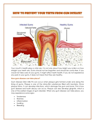 How To Prevent Your Teeth From Gum Disease