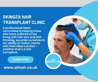 Hair Transplant Clinic London - Skinoza Stratford