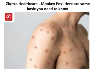 Ziqitza Healthcare - Monkey Pox Here are some basic you need to know