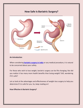 How Safe Is Bariatric Surgery