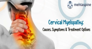 Cervical Myelopathy: Causes, Symptoms & Treatment Options