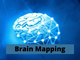 How Does Brain Mapping Help Your Treatment