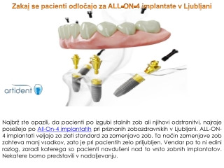 Zakaj se pacienti odločajo za ALL-ON-4 implantate v Ljubljani