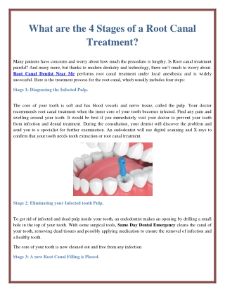 What are the 4 Stages of a Root Canal Treatment?