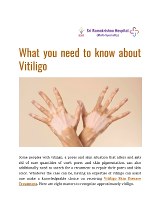 what you need to know about vitiligo (1)