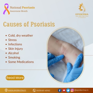 Causes of Psoriasis | Best Dermatology Centre in Jayanagar | Epiderma Clinic