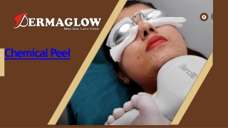 Chemical Peel Near Me