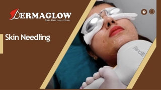 Skin Needling Near Me