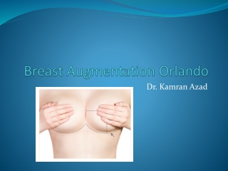 Laser liposuction Orlando