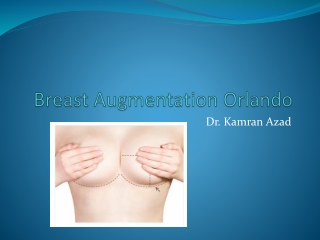 Breast Augmentation Orlando surgery