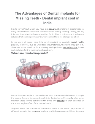 The Advantages of Dental Implants for Missing Teeth | Dental implant cost in ind