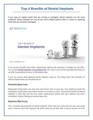 Top 4 Benefits of Dental Implants