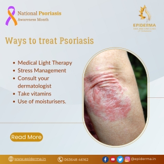 Ways to treat Psoriasis | Best Dermatology Centre in Jayanagar | Epiderma Clinic