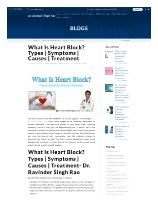 What Is Heart Block- Types-  Symptoms-  Causes-  Treatment