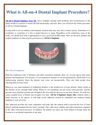 What is All-on-4 Dental Implant Procedure?