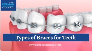 Find the Best Dentist in Indore - Surana Dental Clinic