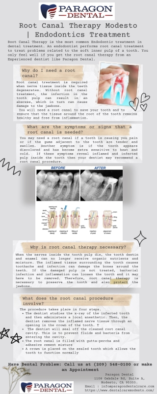 Root Canal Therapy Modesto |  Endodontics Treatment