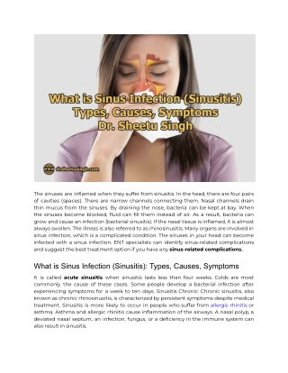 What is Sinus Infection (Sinusitis)_ Types, Causes, Symptoms – Dr. Sheetu Singh