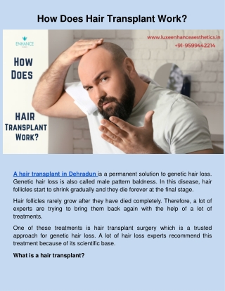 How Does Hair Transplant Work_.docx