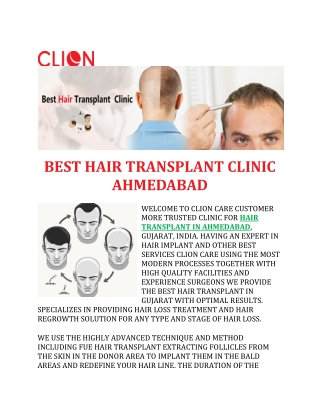 HAIR TRANSPLANT CLINIC AHMEDABAD