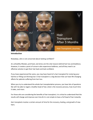 Hair Transplant Journey_ Hair Transplant After 3 Months - Results