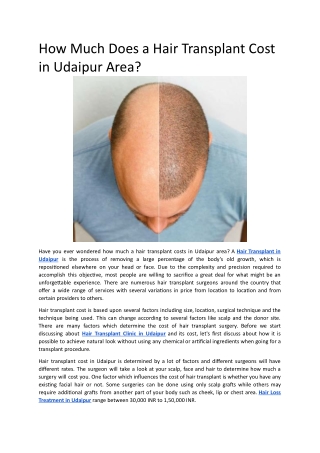 How Much Does a Hair Transplant Cost in Udaipur Area_