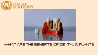 WHAT ARE THE BENEFITS OF DENTAL IMPLANTS