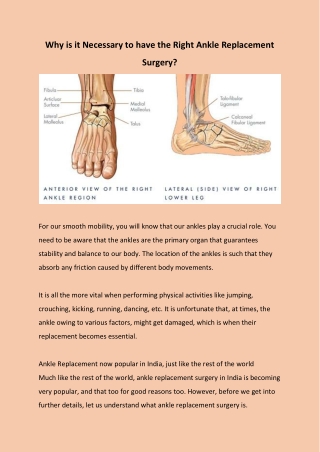 Why is it necessary for having the right Ankle Replacement Surgery