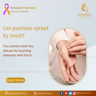 Can psoriasis spread by touch | Dermatologist in Jayanagar | Epiderma Clinic