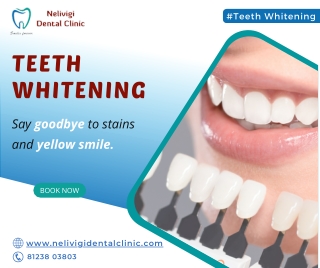 Say goodbye to teeth stains - Dental Clinic in Bellandur - Nelivigi Dental