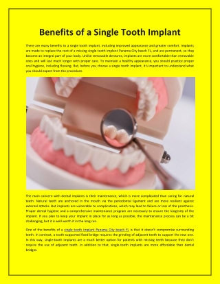 Benefits of a Single Tooth Implant