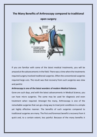 The Many Benefits of arthroscopy compared to traditional open surgery