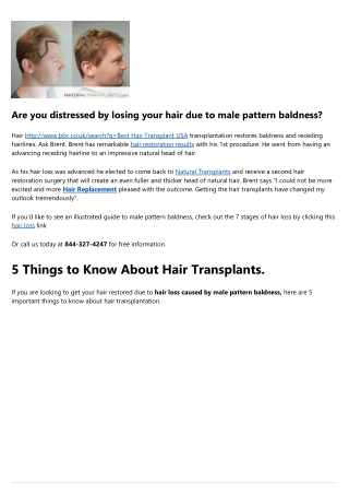 Natural Transplants and  Hair Graft in 2022