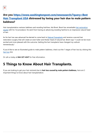 Natural Transplants, Hair Hair Transplantation Center and  Hairline Implant in 2