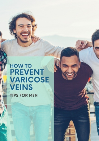 How to Prevent Varicose Veins