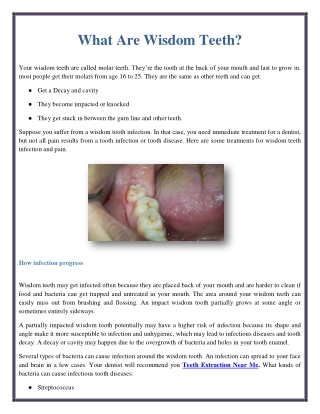 What Are Wisdom Teeth?